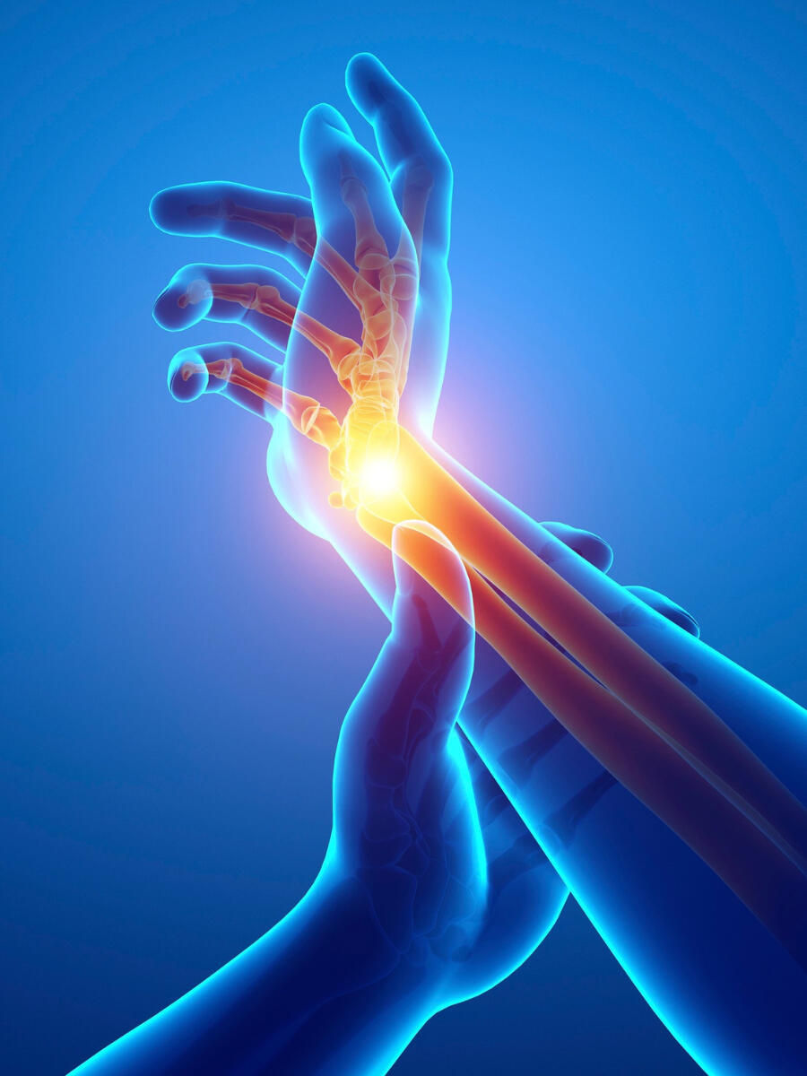 Wrist Photo Jemelik Orthopaedics Waterford