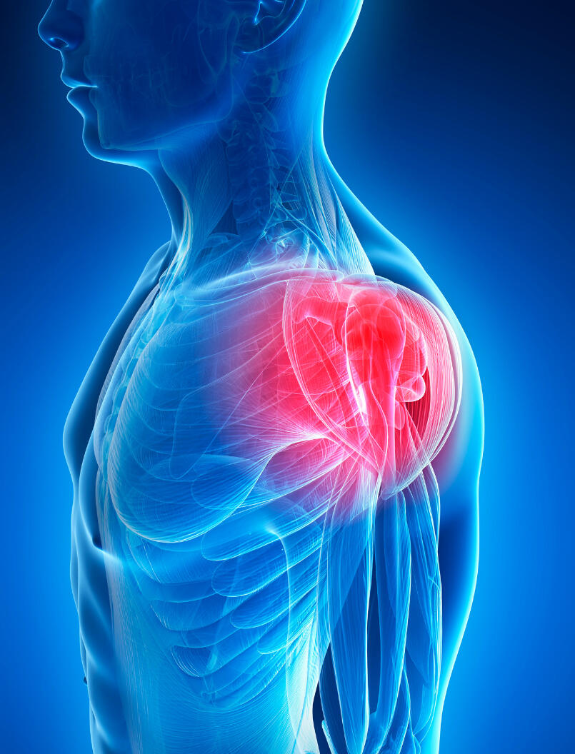 Shoulder Photo Jemelike Orthopaedics Waterford